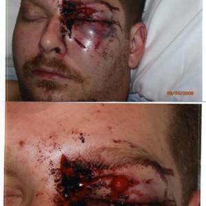 My accident