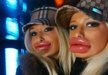big-lips.jpg